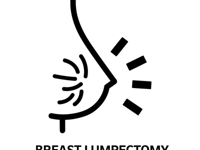 Breast Lumpectomy (Wide Local Excision)