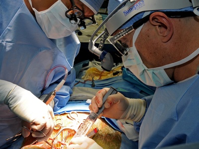 Carotid Endarterectomy