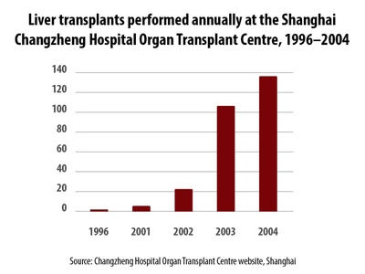 Liver Transplant