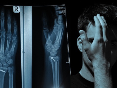 Open Reduction Internal Fixation (ORIF)