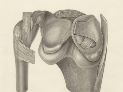 Total Hip Replacement