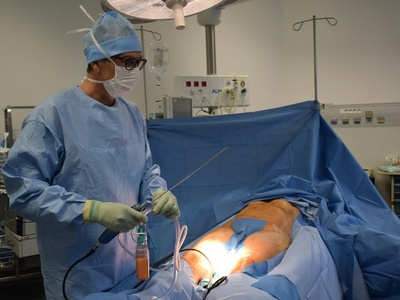 Varicose Vein Surgery (Stripping/Ablation)