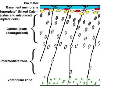 Cajal-Retzius cell