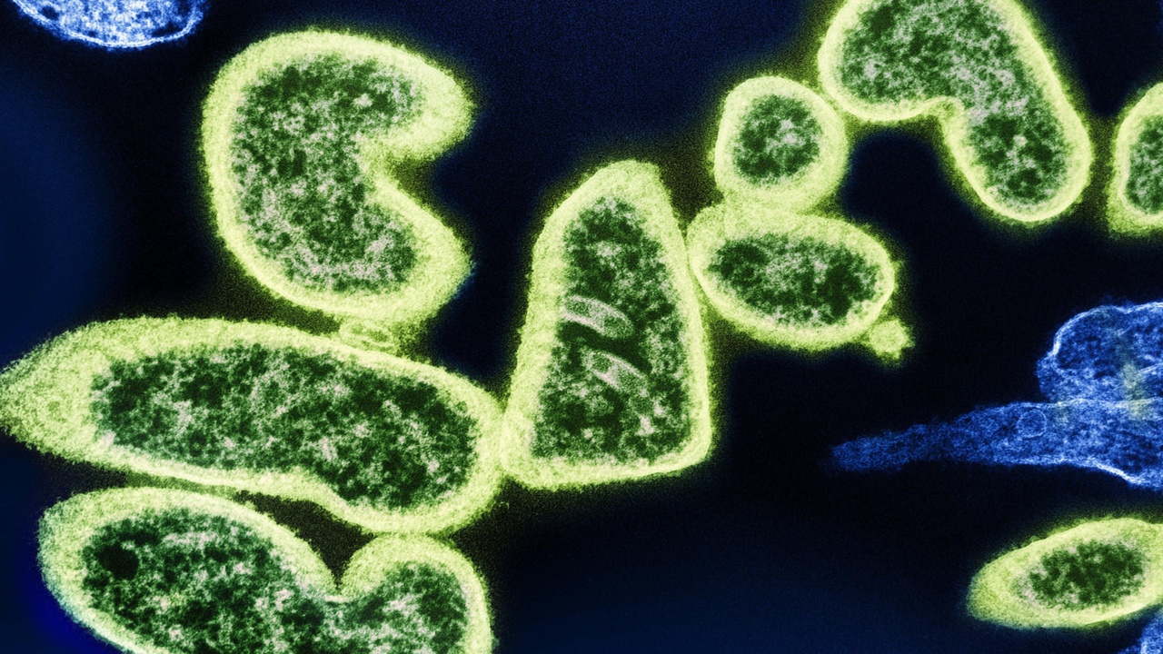 Illustration comparing bacterial and viral symptom patterns, fever curves and clinical exam