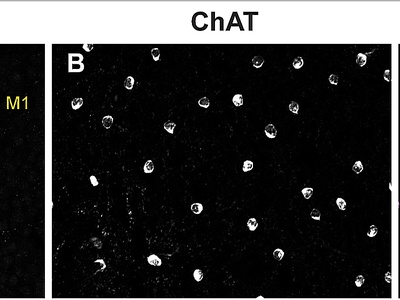 Intrinsically photosensitive retinal ganglion cell (ipRGC)