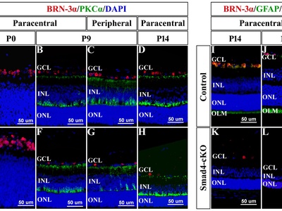 Retinal ganglion cell