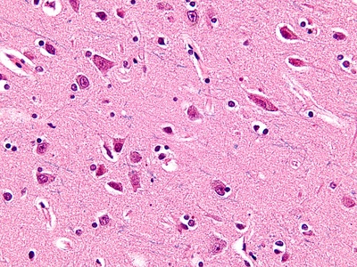 Von Economo neuron (spindle neuron)