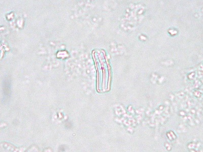 Achnanthidium minutissimum