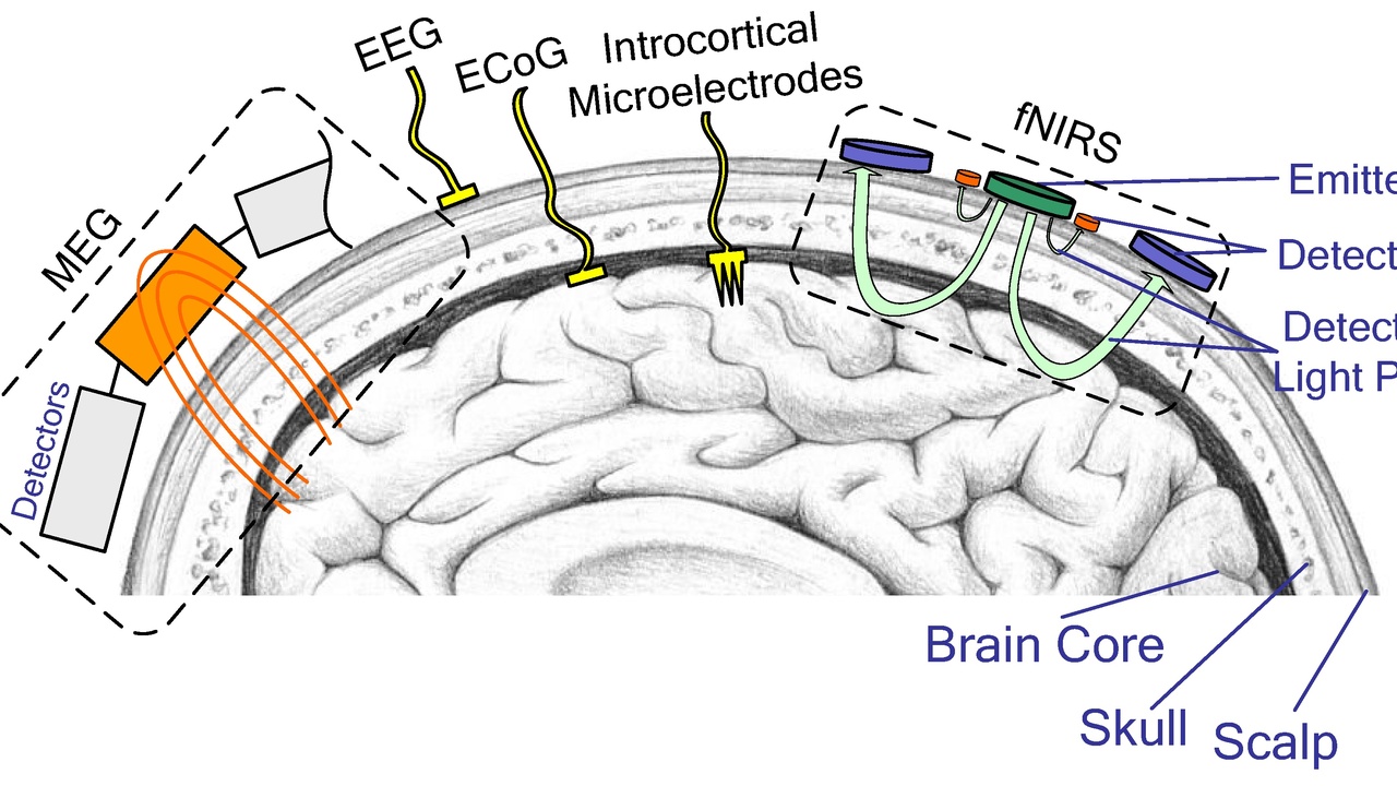 Brain–computer interface and neuroprosthetic device