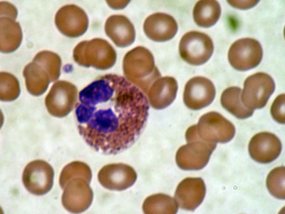 Eosinophil