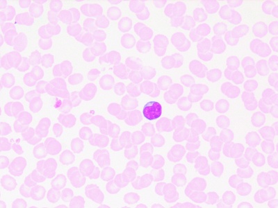 Lymphocyte