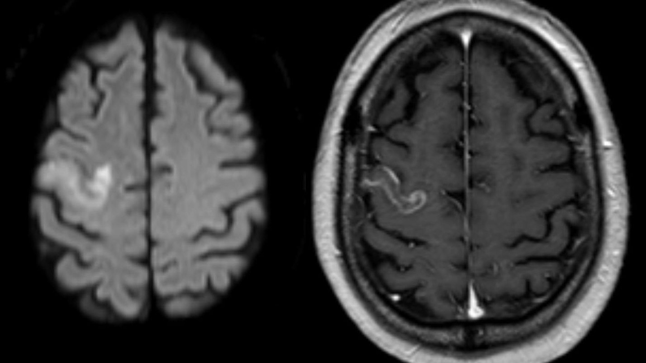 MRI contrast agent vial and hospital MRI scanner