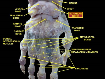 Navicular