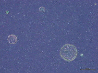 Phaeocystis globosa