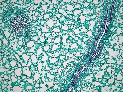 Phloem sieve-tube element