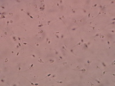 Reproductive health and fertility