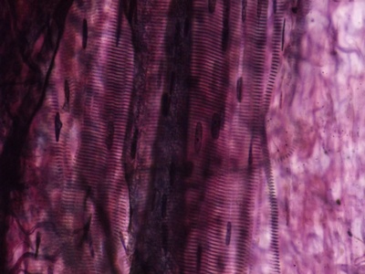 Skeletal muscle cell (myocyte)