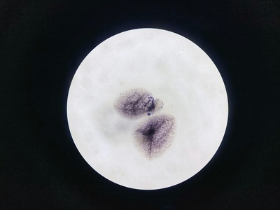 Yeast cell (budding)