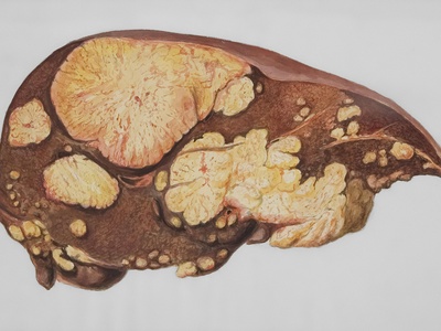 Liver