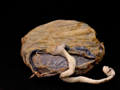 Placenta