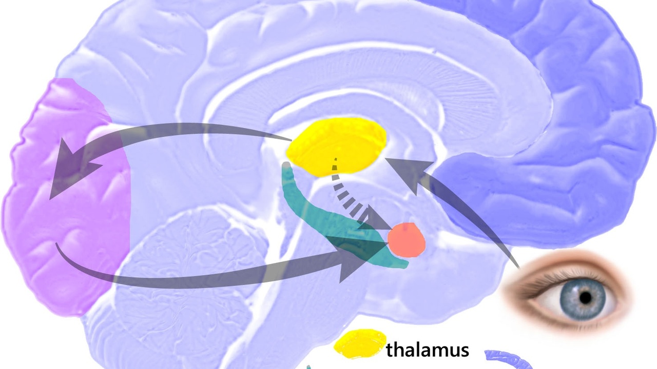 Brain scan highlighting amygdala and prefrontal cortex activity during stress