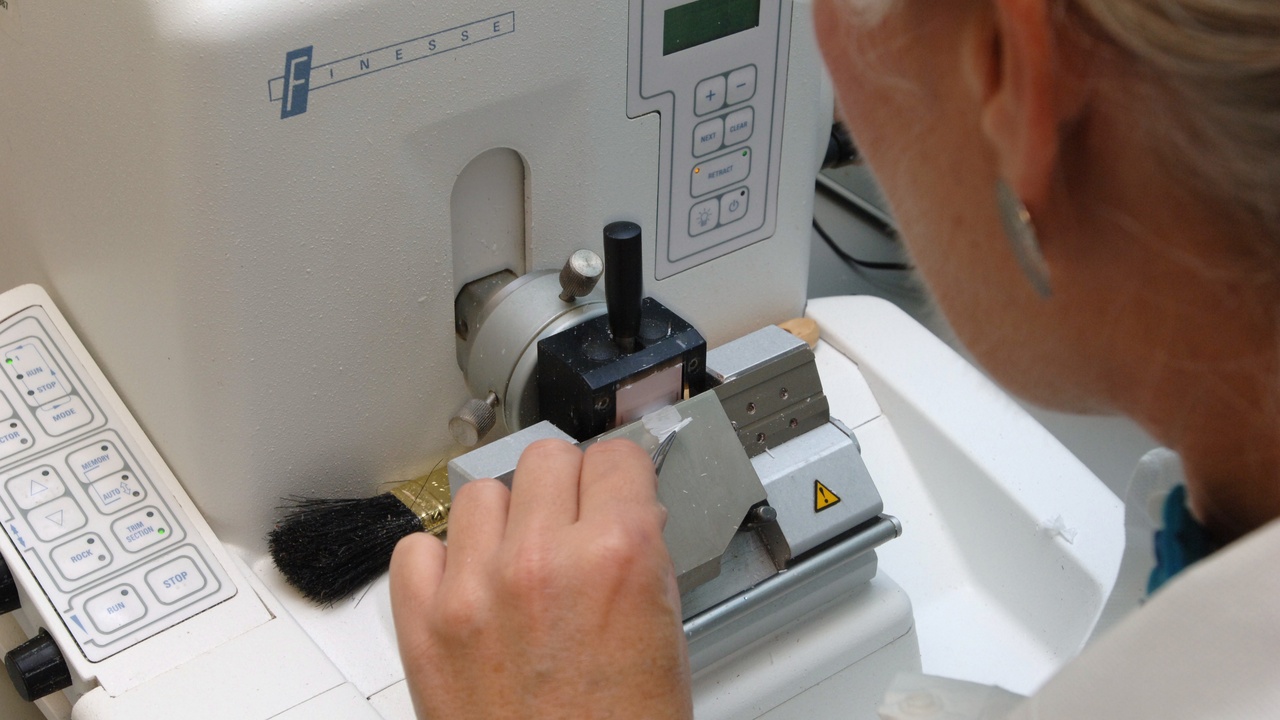 Technician trimming a paraffin block next to a microtome, or a cryostat chamber with a frozen block