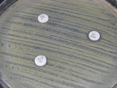 Amoxicillin-clavulanate