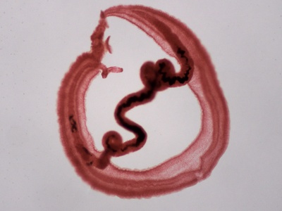 Blood fluke