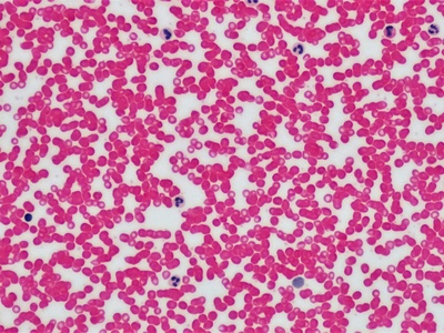 Blood (red blood cells)