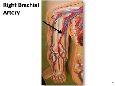 Brachial artery