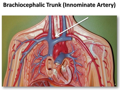 Brachiocephalic trunk