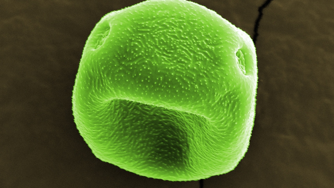 Pollen grains and pet dander under microscope