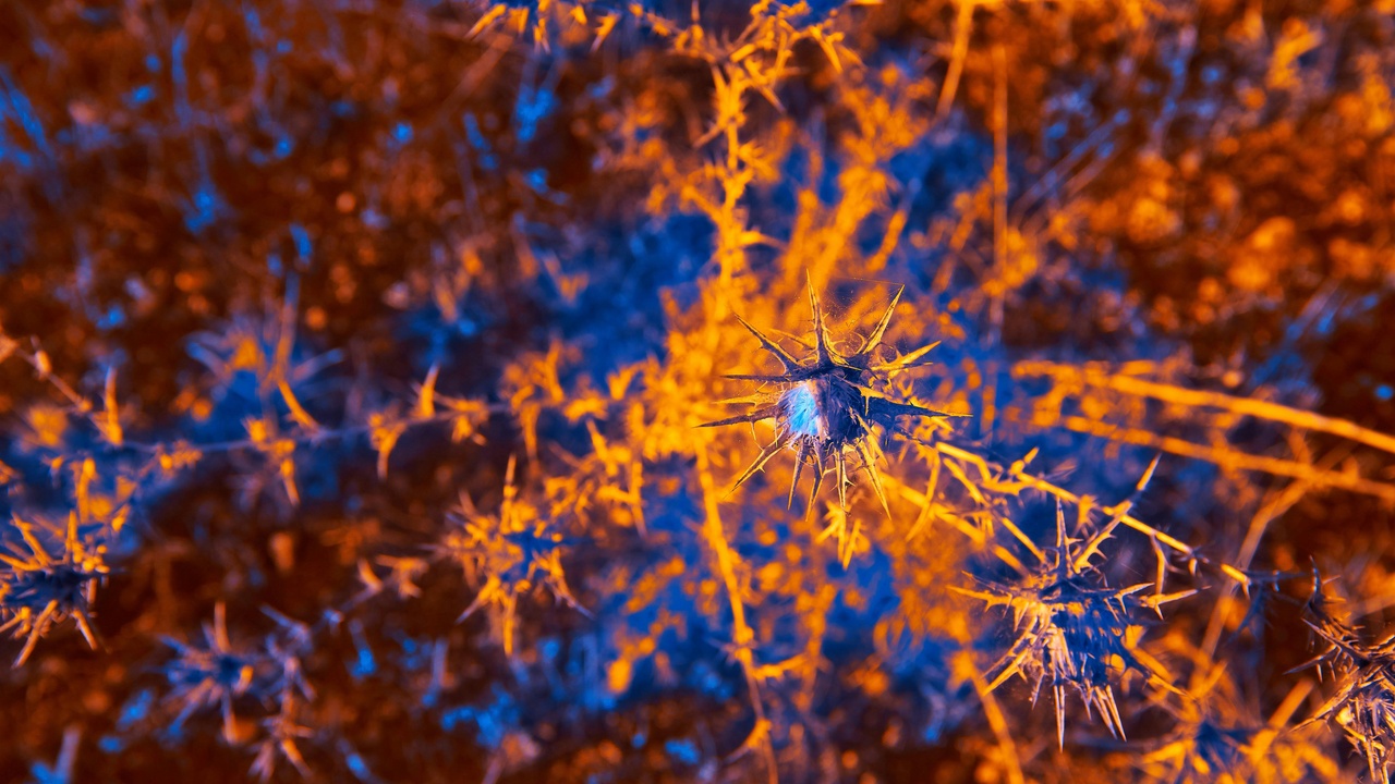 Fluorescent image of neurons forming a network in culture.