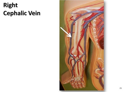 Cephalic vein