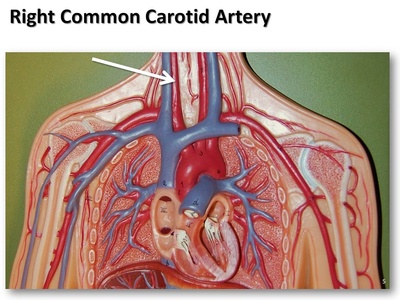 Common carotid artery