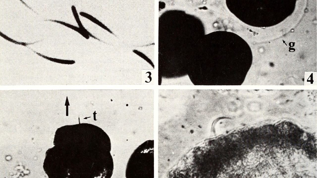 Larval stages of mollusks and echinoderms: trochophore and bipinnaria comparison