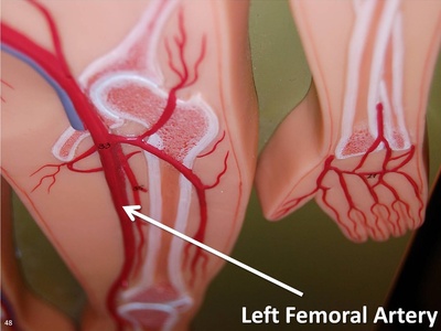 Femoral artery