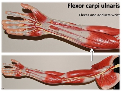 Flexor carpi ulnaris