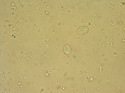 Giardia lamblia