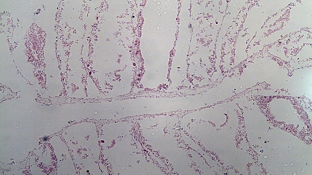 Comparative diagrams of sponge cellular structure and cnidarian tissues
