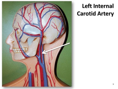 Internal carotid artery