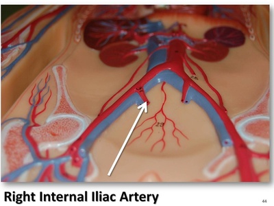 Internal iliac artery