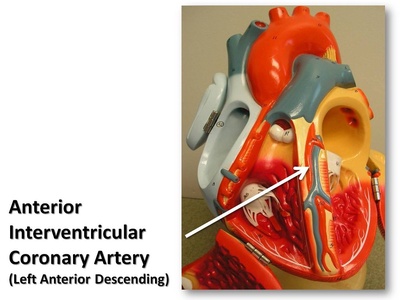 Left anterior descending artery (LAD)