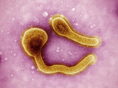 Marburg virus disease