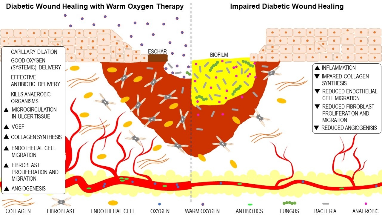 Medical uses of oxygen: oxygen cylinder and alveoli illustration
