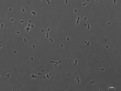 Methanobrevibacter