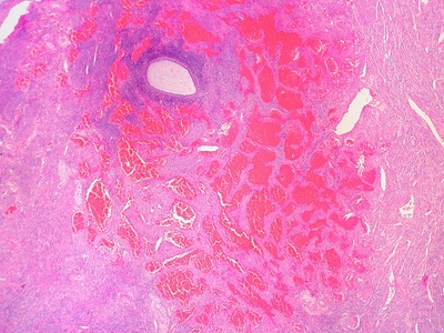 Myometrium