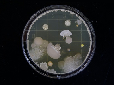 Petri Dish