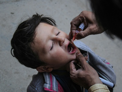 Polio (Poliomyelitis)