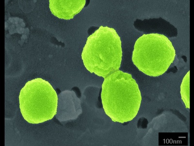 Prochlorococcus